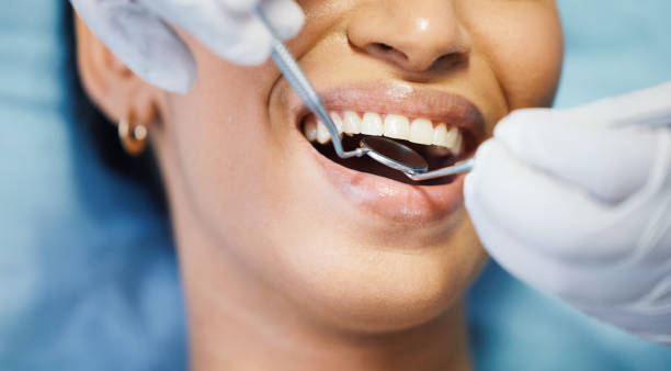 Best Emergency Cosmetic Dentistry in Edmonds, WA